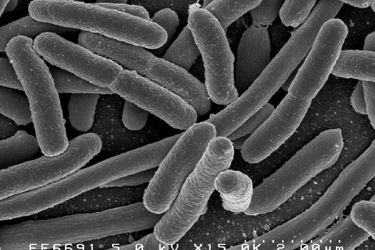 Scanning electron micrograph of rod-shaped bacteria